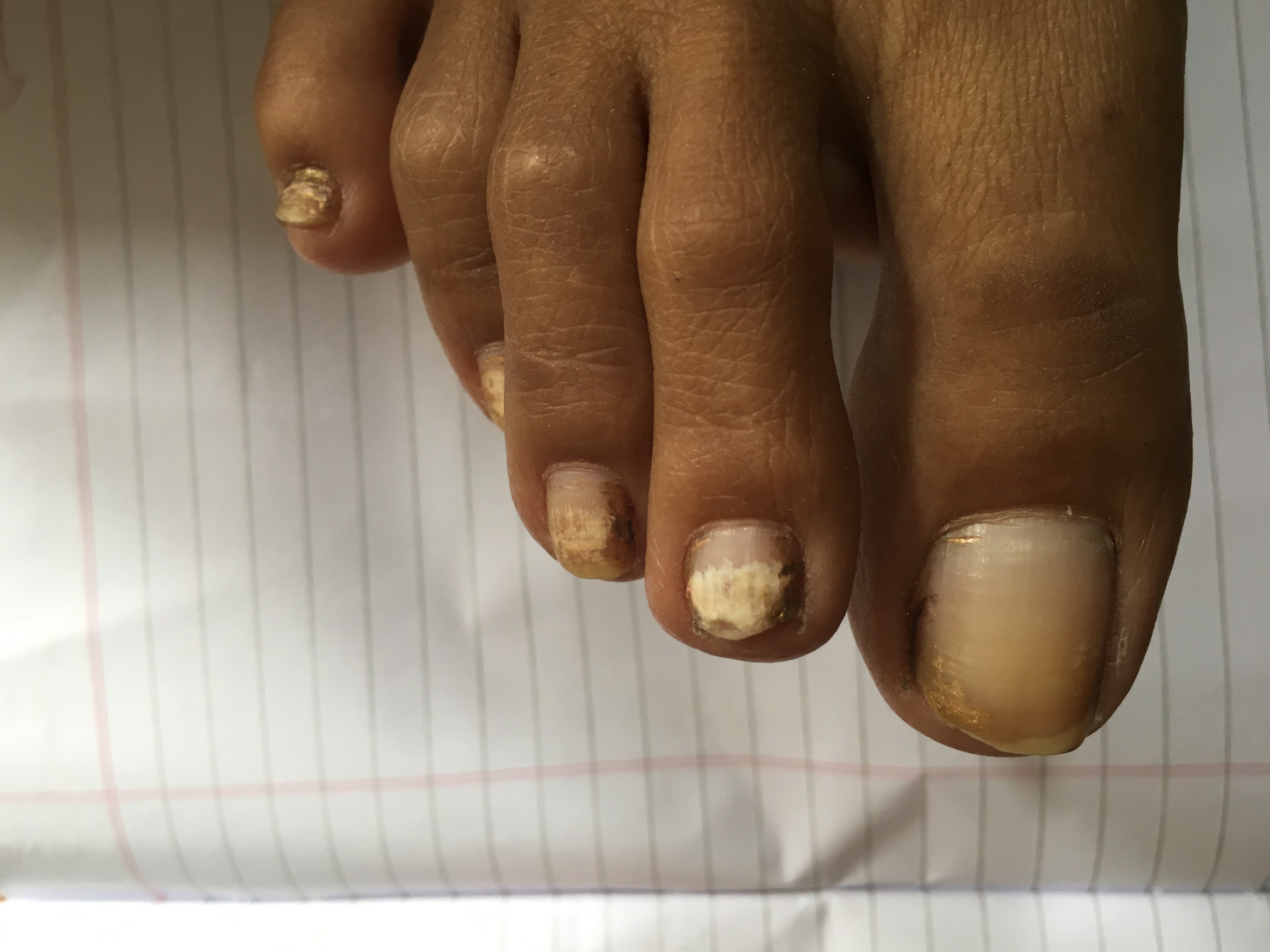 Diagnose This Condition
